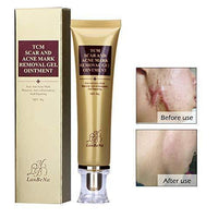 Wisdompark Acne Scar Removal Cream Skin Repair Face Cream Acne Spots Acne Treatment Blackhead - Eva Curly