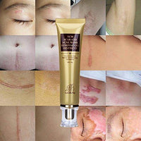 Wisdompark Acne Scar Removal Cream Skin Repair Face Cream Acne Spots Acne Treatment Blackhead - Eva Curly