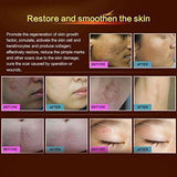Wisdompark Acne Scar Removal Cream Skin Repair Face Cream Acne Spots Acne Treatment Blackhead - Eva Curly